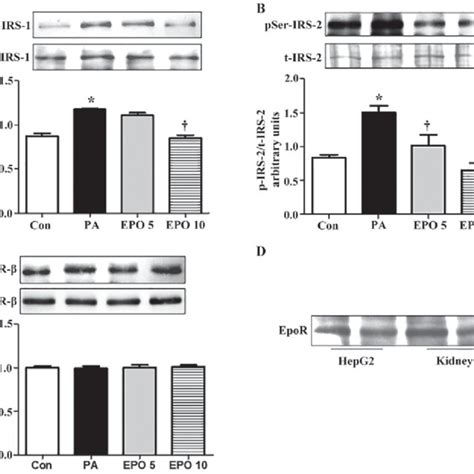 Effects Of Pi3k Inhibitors On The Phosphorylation Of Pi3k Akt Foxo1 And Download Scientific