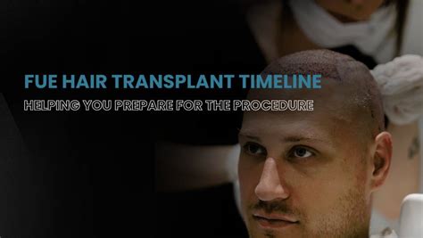 Fue Hair Transplant Timeline Bluemagic Group