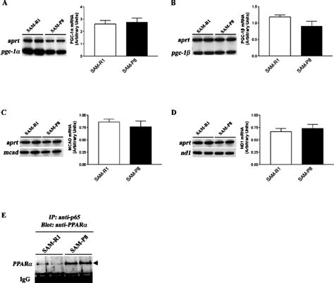 Increased Peroxisome Proliferator Activated Receptor A Ppar A