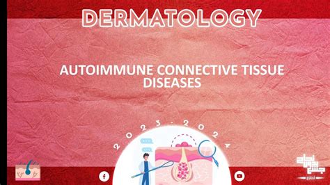 L9 Part 2 Autoimmune Connective Tissue Diseases Dermatology Youtube