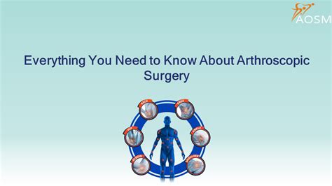 Ppt Everything You Need To Know About Arthroscopic Surgery Powerpoint