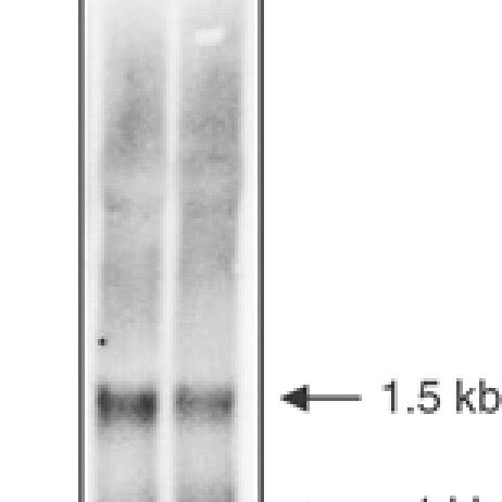 Expression Of Gfp In Transfected Cells Shows That The Mrna Has Been