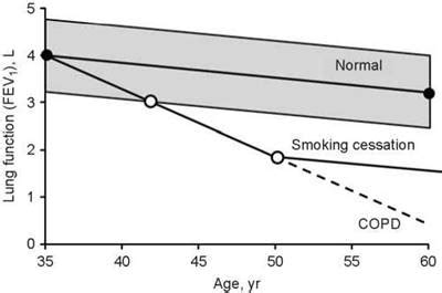 When To Test And What To Order Interpretation Of Pulmonary Function