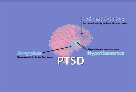 Trauma And Ptsd Understanding The Brain In The Midst Of Recovery — Greymatterstu