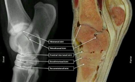 Horse Hock Anatomy Horse Anatomy Horse Massage Horse Health