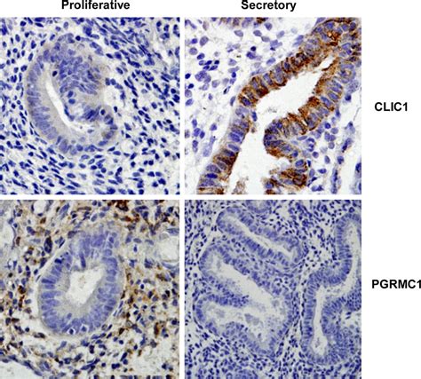 Proteomics Of The Human Endometrium And Uterine Fluid A Pathway To