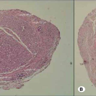 Photomicrographs Of Cross Sections Of Nerve Segments A The Control