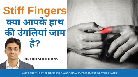 What Are The Stiff Fingers Diagnosis And Treatment Of Stiff Finger