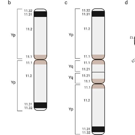 The Most Common Structural Y Chromosome Abnormalities Are A Deletions Download Scientific