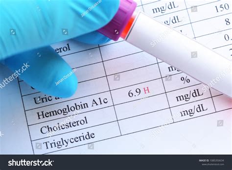 376 Hemoglobin A1c Images Stock Photos Vectors Shutterstock