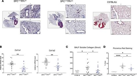 Jci Insight Pgf Signaling Drives Fibrotic Remodeling And Fibroblast