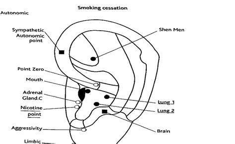 Battlefield Acupuncture Rapid Auriculotherapy Technique For Pain Reduction