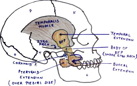 Retrospective Analysis Of Use Of Buccal Fat Pad As An Interpositional