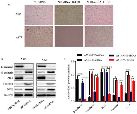 Nfib Promotes Invasion And Proliferation Of A375 And A875 Cells By