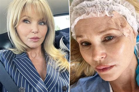 Christie Brinkley Reveals Skin Cancer Diagnosis Total News