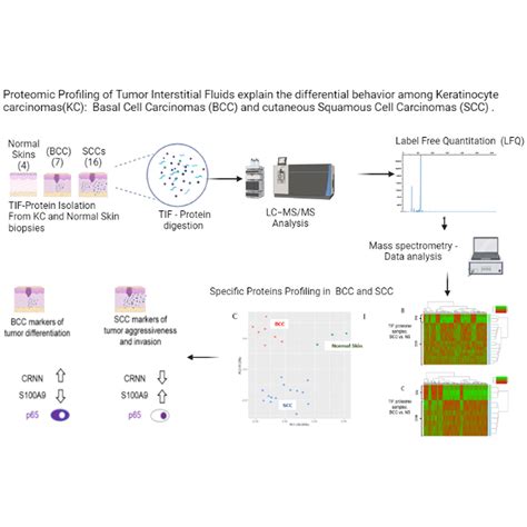 Biomarkers Found In The Tumor Interstitial Fluid May Help Explain The