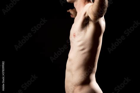 Side View Of A Fibrous Nude Man With Kyphosis And Lordosis Due To The