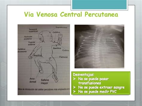 Procedimientos En Neonatologia I Ppt