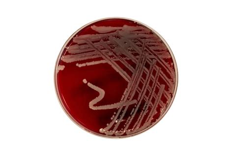 Thermo Scientific Blood Agar Tsa With Sheep Blood Medium