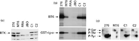 A Western Blot Analysis Of Btk Protein Expression In B Lymphoblastoid