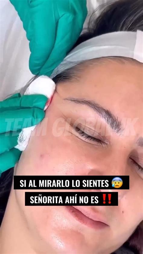 NO MALTRATES MÁS TÚ ROSTRO Mejor usa tu Galvánica Facial Pedidos