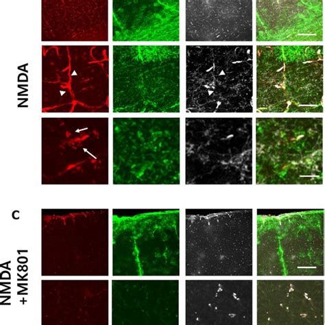 Activation Of Nmda Receptor Induces Rapid Dislocalization Of Markers