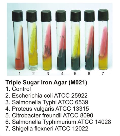 TRIPLE SUGAR IRON (TSI AGAR) - Microbiology Lab Notes