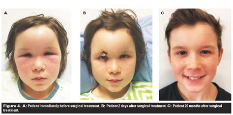 4 Times Sinusitis A Year - autoblog kesehatan