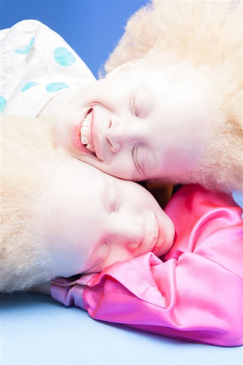 11-Year-Old Albino Twins Are Taking over the Fashion World