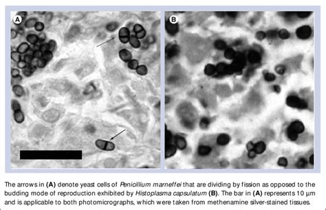 Penicillium Marneffei Morphology