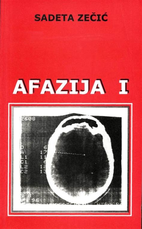 Afazija I – OD "MOJ GLAS"