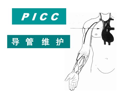 Picc导管维护word文档在线阅读与下载无忧文档