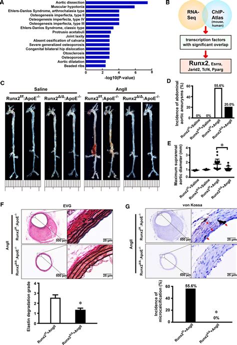 Runx2 Runt Related Transcription Factor 2 Mediated Microcalcification