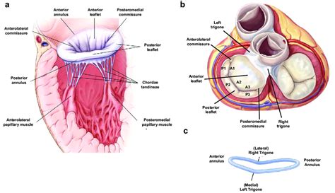 Mitral Valve Anatomy In A Long Axis View And B Short Axis View C