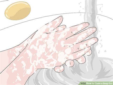 3 Ways To Clean A Deep Cut Wikihow