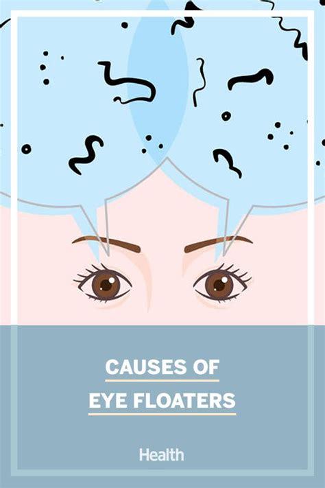 Eye floaters ophthalmologists explain causes symptoms and treatment ...