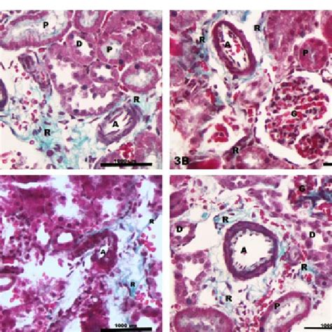 Light Photomicrographs Of Masson Trichrome Stained Sections Of Rat