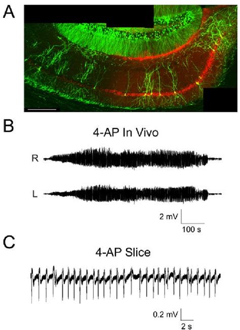 Figure 1 From Hippocampal Seizures Cause Depolymerization Of