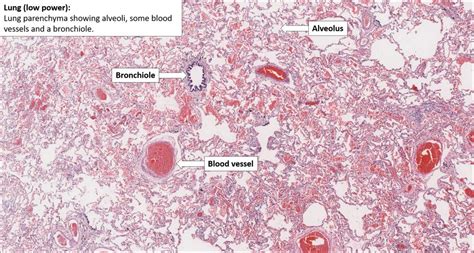 Lung Normal Histology Nus Pathweb Nus Pathweb