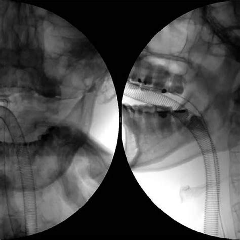 Intraoperative Fluoroscopic Images Under General Anesthesia Manual