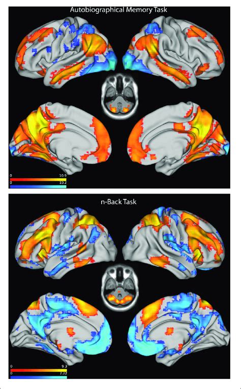 Top Statistical Parametric Map Showing Activation Combined Across