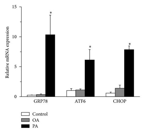 There Is A Crosstalk Between ER Stress And Necroptosis In PA Induced