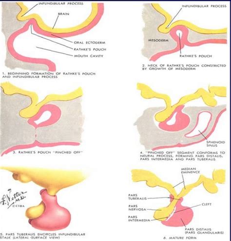 Pituitary Disorders Flashcards Quizlet