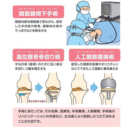 変形性膝関節症後藤整形外科医院福岡市中央区鳥飼の整形外科リウマチ科リハビリテーション科外科