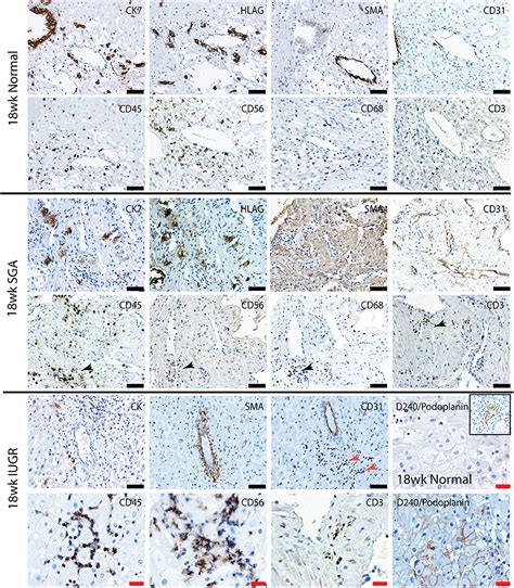 Frontiers Failure Of Decidualization And Maternal Immune Tolerance