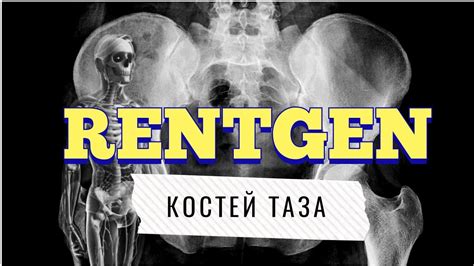 Рентген таза: учимся читать рентген костей таза📖🙈 - YouTube