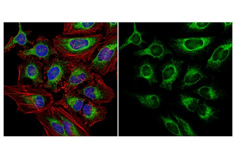 Calnexin C5c9 Rabbit Mab Alexa Fluor® 488 Conjugate Cell