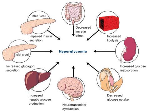 Multifactoral Nature Of Hyperglycemia In Patients With Type 2 Diabetes