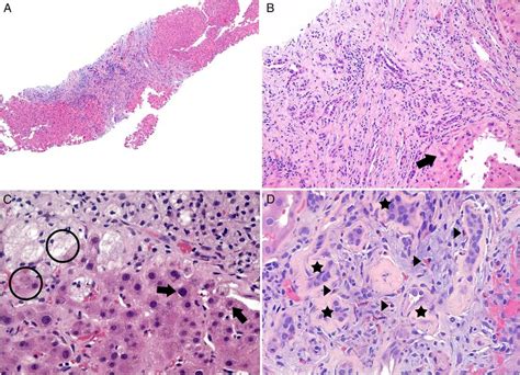 A Liver 340 Hematoxylin And Eosin Hande Stain Largely Preserved