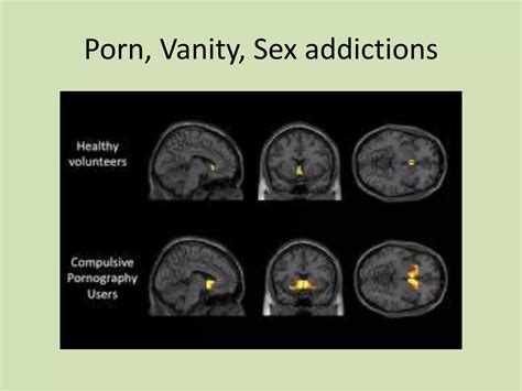 Addiction Is A Brain Disease Ppt